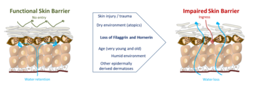 Fig 1. Skin barrier function.  